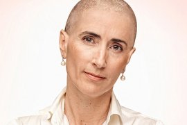 Sernam lanza campaña contra cáncer de mama con conocidas mujeres chilenas «rapadas» entre ellas la ministra Schmidt, en la foto