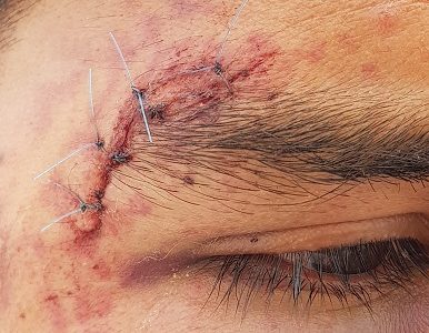 INDH Tarapacá interpuso primera querella contra funcionarios del Ejército, por el delito de torturas