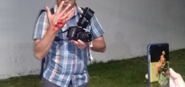Reportero gráfico recibe postonazo disparado desde el interior de la Sexta División de Ejército