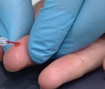 Sernac denuncia a empresa de test rápido Covid 19, por publicidad engañosa e investiga a otras