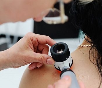 Especialista explica método “ABCDE” para detectar lunares malignos y complicaciones a la piel