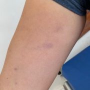 “¿Te vas a alinear o no?” habría preguntado Gobernador del Tamarugal Natan Olivos a funcionaria que acusa agresión de su parte