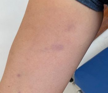 “¿Te vas a alinear o no?” habría preguntado Gobernador del Tamarugal Natan Olivos a funcionaria que acusa agresión de su parte