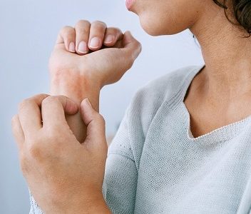 Encuesta a pacientes que padecen psoriasis entrega reveladores datos sobre esta patología en Chile