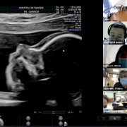 En el Hospital de Iquique realizan examen piloto para detectar Anomalías Congénitas Mayores mediante Telemedicina