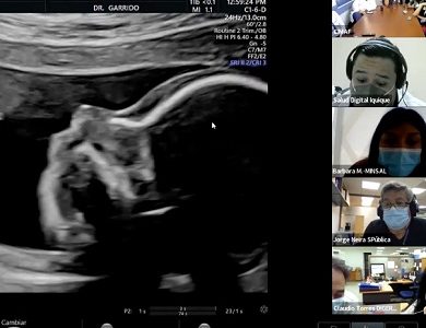 En el Hospital de Iquique realizan examen piloto para detectar Anomalías Congénitas Mayores mediante Telemedicina