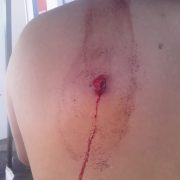 Joven boliviano es atendido por herida de perdigón en  Colchane, luego de huir desde Bolivia, involucrado en caravana de autos de contrabando