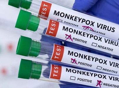 Salud Confirma primer caso de Viruela del mono en Tarapacá: Hombre de 30 años trasladado a residencia sanitaria